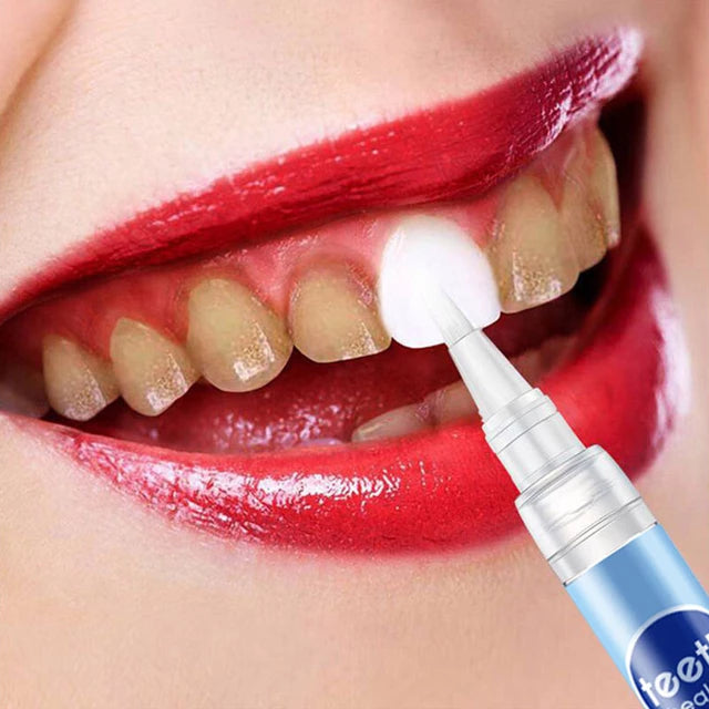Teeth Whitening Pen Remove Stains Oral Care Teeth Bleaching Gel - Tuzzut.com Qatar Online Shopping