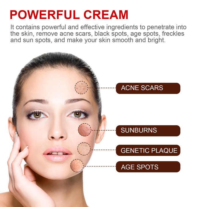 professional facial freckle removal face cream - Tuzzut.com Qatar Online Shopping