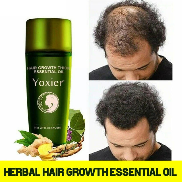 Herbal Hair Growth Essential Oil Effective Fast Growth Growth Serum Hair Hair Treatment - Tuzzut.com Qatar Online Shopping