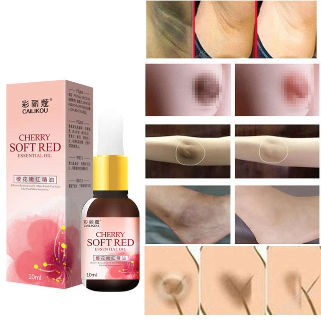 Intimate area pink essential oil body whitening cream hip breast private parts Remove Melanin dull beauty care - Tuzzut.com Qatar Online Shopping