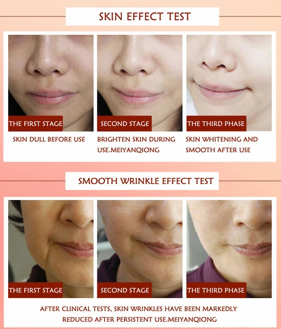 Face-lift Slimming Cream Face Lift Firming Removal Masseter Muscle Double Chin Anti-aging Moisturizing Beauty Skin Care 30ml - Tuzzut.com Qatar Online Shopping
