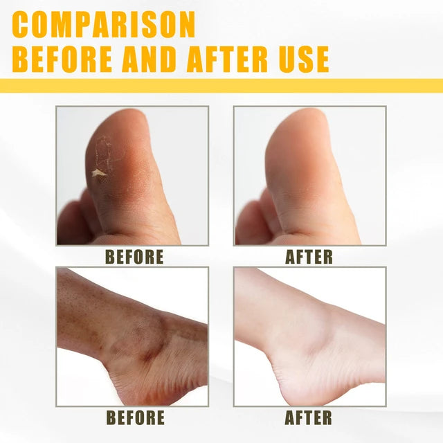 Yellow Peeling Oil Dark Skin Bleaching Remove Arm Knee Legs -50ml - Tuzzut.com Qatar Online Shopping