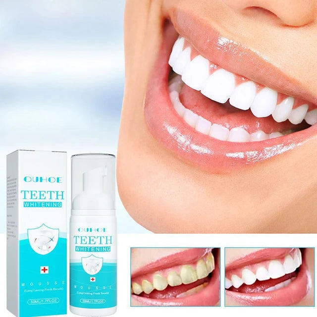 Ultra-Fine Mousse Foam Deep Cleansing Whitening Freshen Breath Whiten Teeth Dissolve Tooth Stains And Clean Toot Foam - Tuzzut.com Qatar Online Shopping