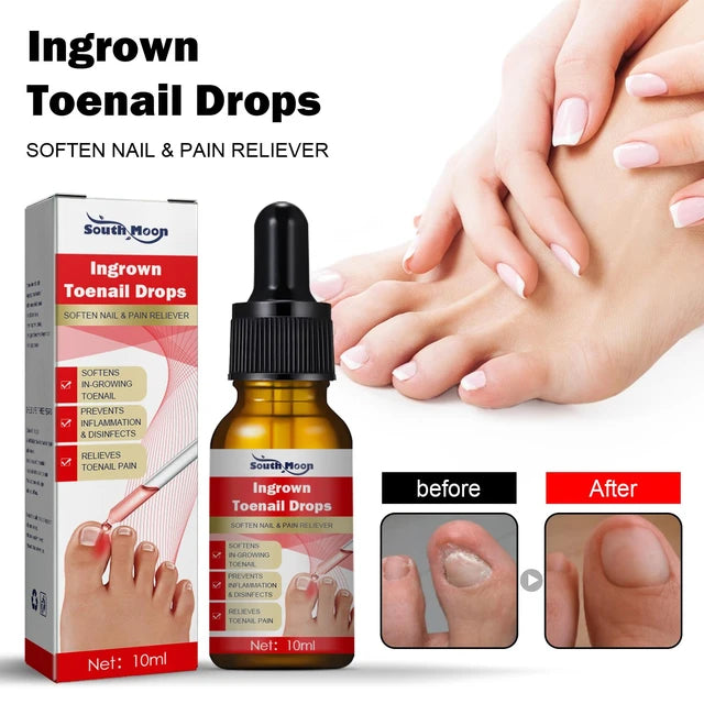 Ingrown Toenail Treatment Serum Nail Correction Recover Oil Pain Reliever Nail Softener Trim with Ease Oil Feet Health Care - Tuzzut.com Qatar Online Shopping