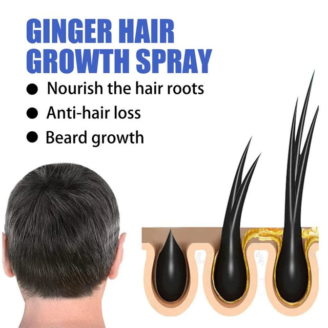 Hair Growth Spray Anti Hair Loss Product Essential Oil - Tuzzut.com Qatar Online Shopping