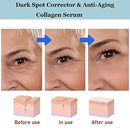 Anti-Wrinkle Eye Cream HYAKUON YouthRestore NMN Eye Cream Remove Dark Circle Eye Care Lifting Fade Eye Bag Eye Essence Cream - Tuzzut.com Qatar Online Shopping