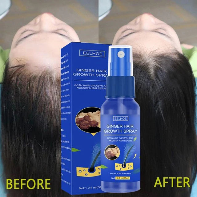 Hair Growth Spray Anti Hair Loss Product Essential Oil - Tuzzut.com Qatar Online Shopping